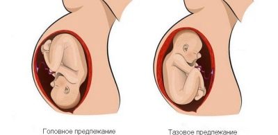 31 неделя беременности: Что происходит ощущения развитие плода